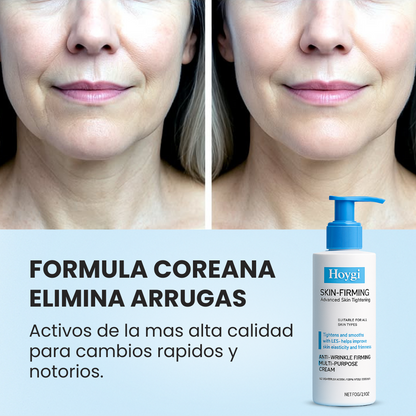 Hoygi® SkinFirm Reafirmante Facial Intenso