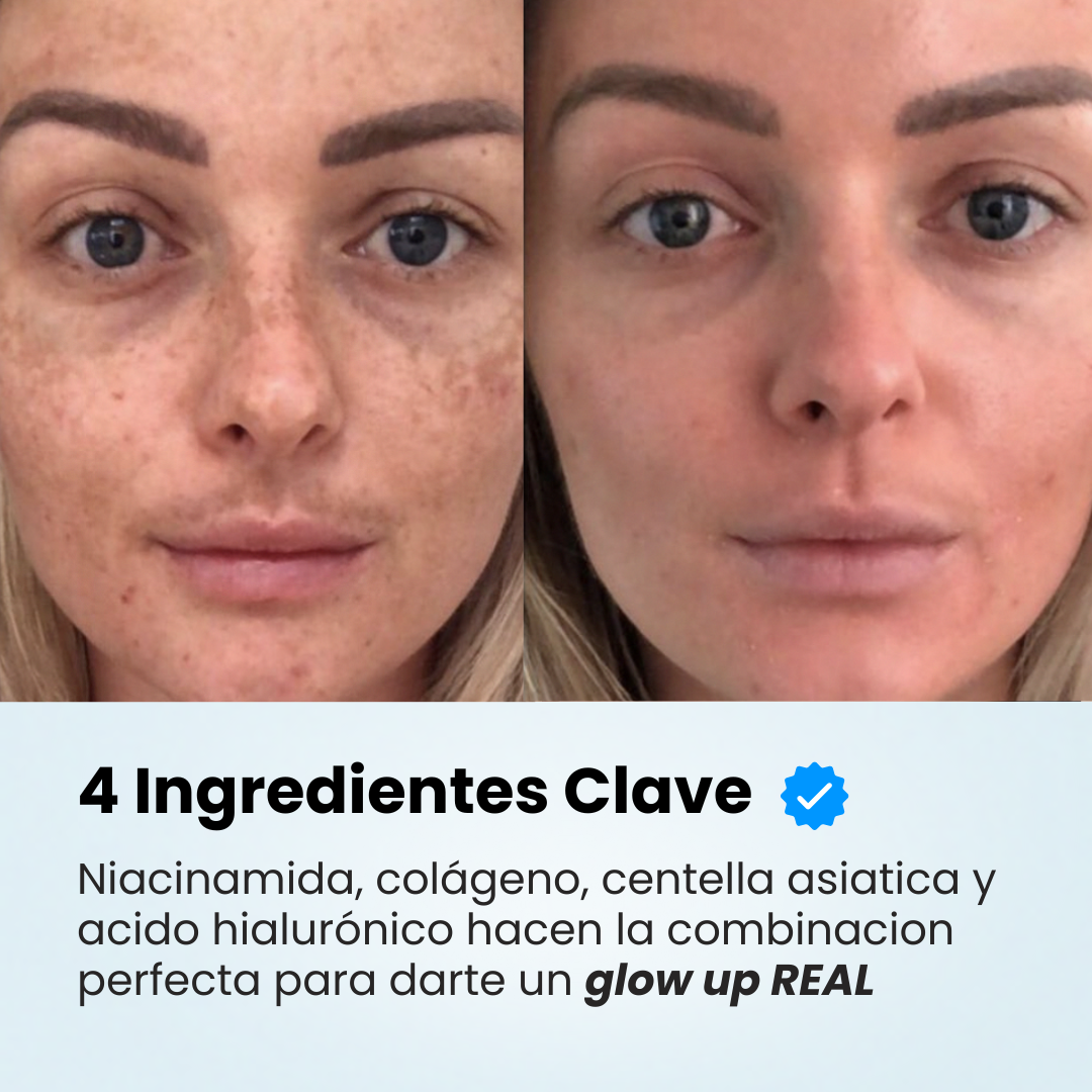 NIDA FaceCream - Coreana Profesional